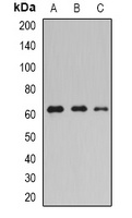tPA Rabbit Polyclonal Antibody