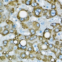 Adipophilin Antibody