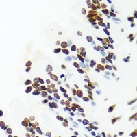 Anti-PNKP Antibody