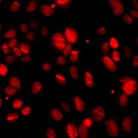 Anti-PNKP Antibody