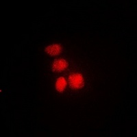 DNA polymerase theta antibody