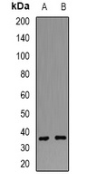 POLR2C Rabbit Polyclonal Antibody