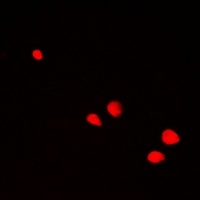 Anti-POLR2D Antibody