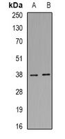 PON2 Rabbit Polyclonal Antibody
