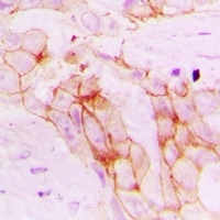 Anti-POR Antibody