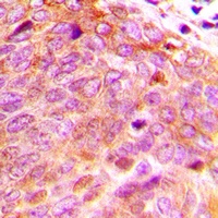 Anti-PPP2CB Antibody