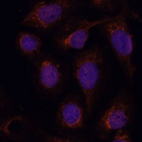 Anti-PPP2CB Antibody
