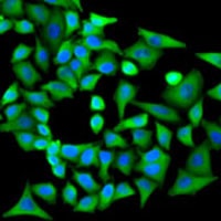 Anti-PPP2R1A Antibody