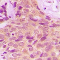 Anti-PPP2R4 Antibody
