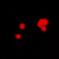 PPP2R4 antibody