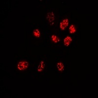 Anti-PPP3CA Antibody