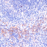 Anti-Perforin 1 Antibody