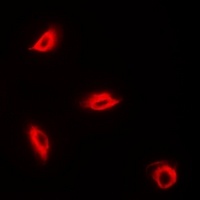 Anti-Perforin 1 Antibody