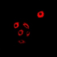 Anti-AMPK beta 2 Antibody