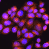 Anti-Presenilin 2 Antibody