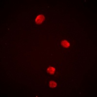 Anti-PSMD13 Antibody
