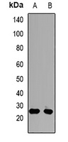 PSMD9 Rabbit Polyclonal Antibody