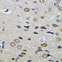 Anti-PTP epsilon Antibody