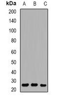 RAB27 Rabbit Polyclonal Antibody