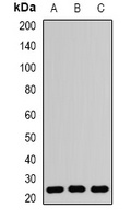 RAB5A Rabbit Polyclonal Antibody