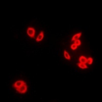 RAB5A Rabbit Polyclonal Antibody