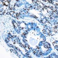 Anti-RBBP5 Antibody