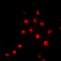 Anti-RBBP5 Antibody