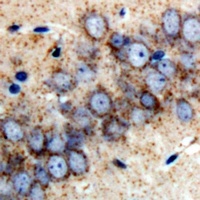 Anti-RBP2 Antibody