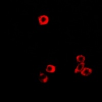 Anti-RBP2 Antibody