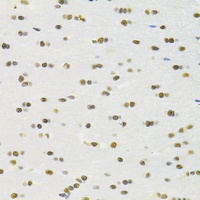 Anti-RBPJ Antibody