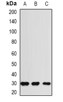 RGR Rabbit Polyclonal Antibody