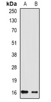 RHEB Rabbit Polyclonal Antibody