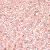 Anti-RNF5 Antibody