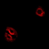 Anti-RPL14 Antibody