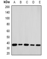 RPLP0 Antibody