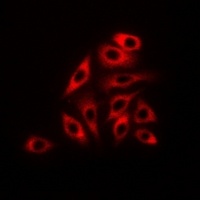 Anti-RPLP0 Antibody