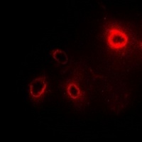 Anti-RPLP1 Antibody