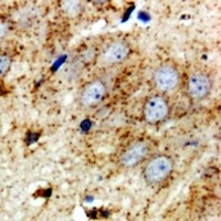 Anti-RPS10 Antibody