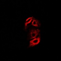Anti-RPS10 Antibody