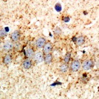 Anti-RPS3A Antibody