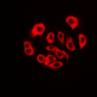 Anti-RPS3A Antibody