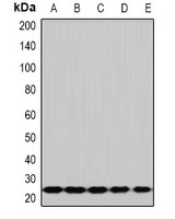 RPS5 Antibody