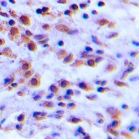 Anti-S100-A12 Antibody