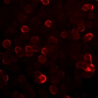 Anti-S100-A12 Antibody