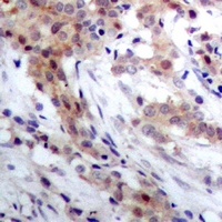 S100A4 antibody