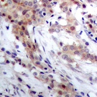Anti-S100-A4 Antibody