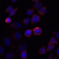 Anti-S100-A4 Antibody