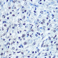 Anti-SAMHD1 Antibody