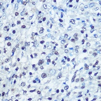 SAMHD1 antibody