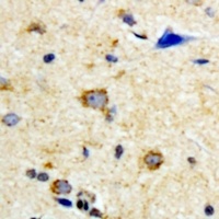 Anti-SCO2 Antibody
